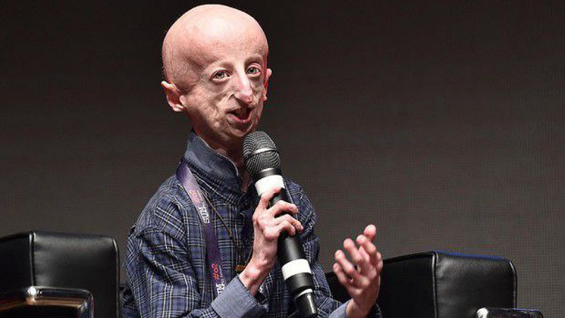 Muere a los 28 aÃ±os de edad italiano que estudiaba el envejecimiento relÃ¡mpago