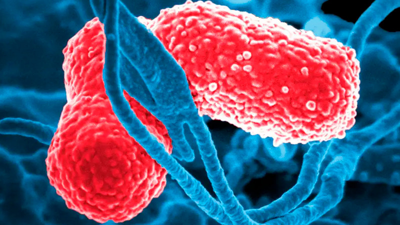 Anuncia Sheinbaum investigaciÃ³n por bacteria que causÃ³ muertes de 13 menores en Edomex