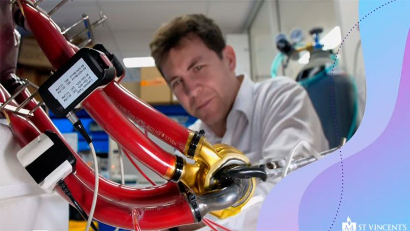 Vive australiano mÃ¡s de 100 dÃ­as con un corazÃ³n artificial de titanio