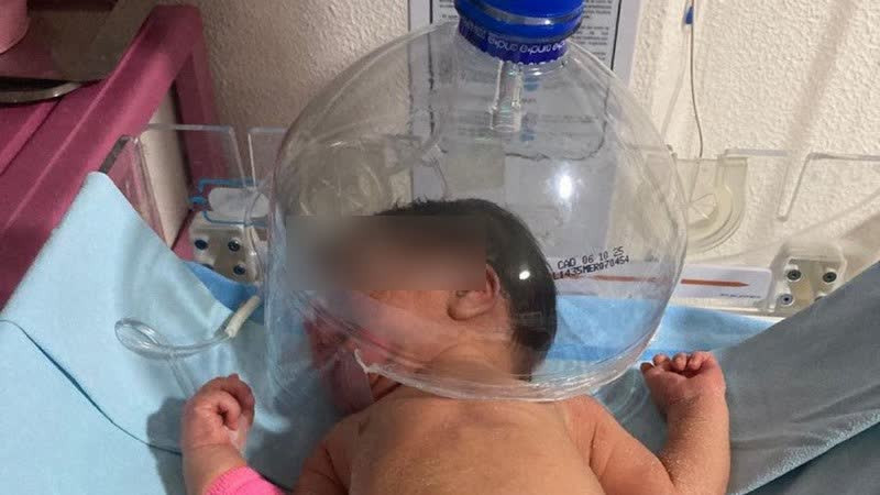 Â¡Solo en MÃ©xico!: usan botella de plÃ¡stico para oxigenar a reciÃ©n nacido en IMSS Tabasco