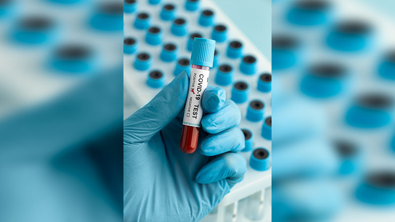 Ordenan labores virtuales a empleados públicos por brote de Covid 19 en Honduras