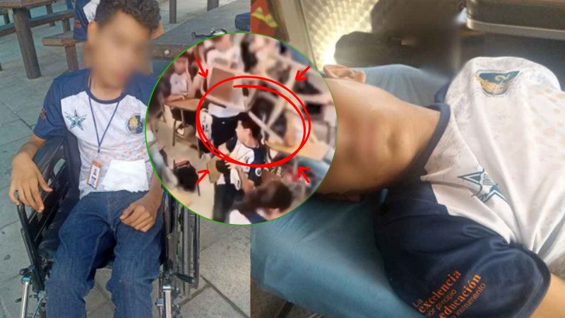 Estudiante de Preparatoria 2 queda en silla de ruedas tras recibir un golpe con una banca en clases; investigan posible negligencia de autoridades escolares